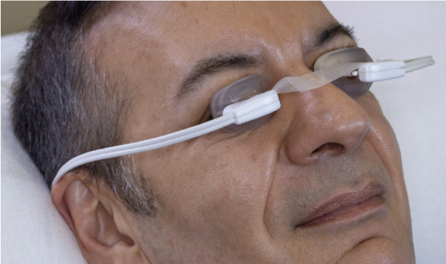 LipiFlow treatment applicator